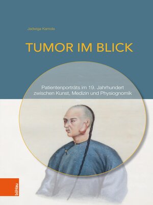 cover image of Tumor im Blick
